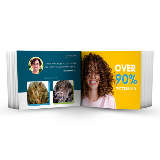 Before & After Lobby Book