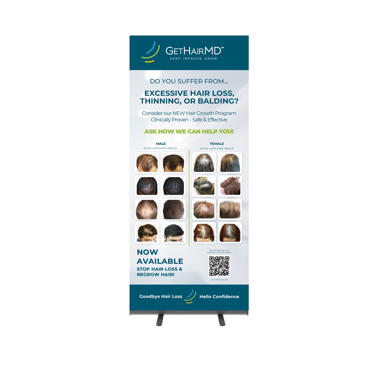 GetHairMD Retractable Banner: Before & After Results